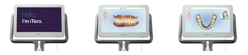 iTero Element